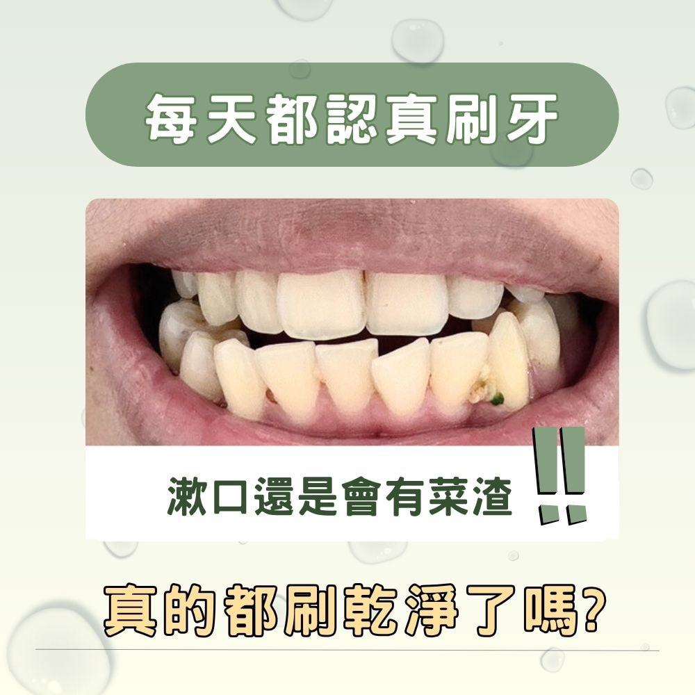 菜渣掰掰沖牙機